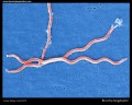 Borrelia burgdorferi electron microscopy